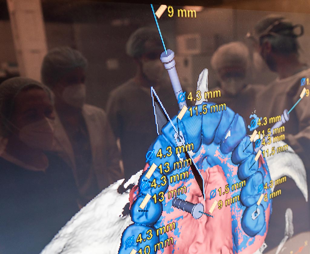 Cirugía guiada por ordenador - Clínica Vilaboa