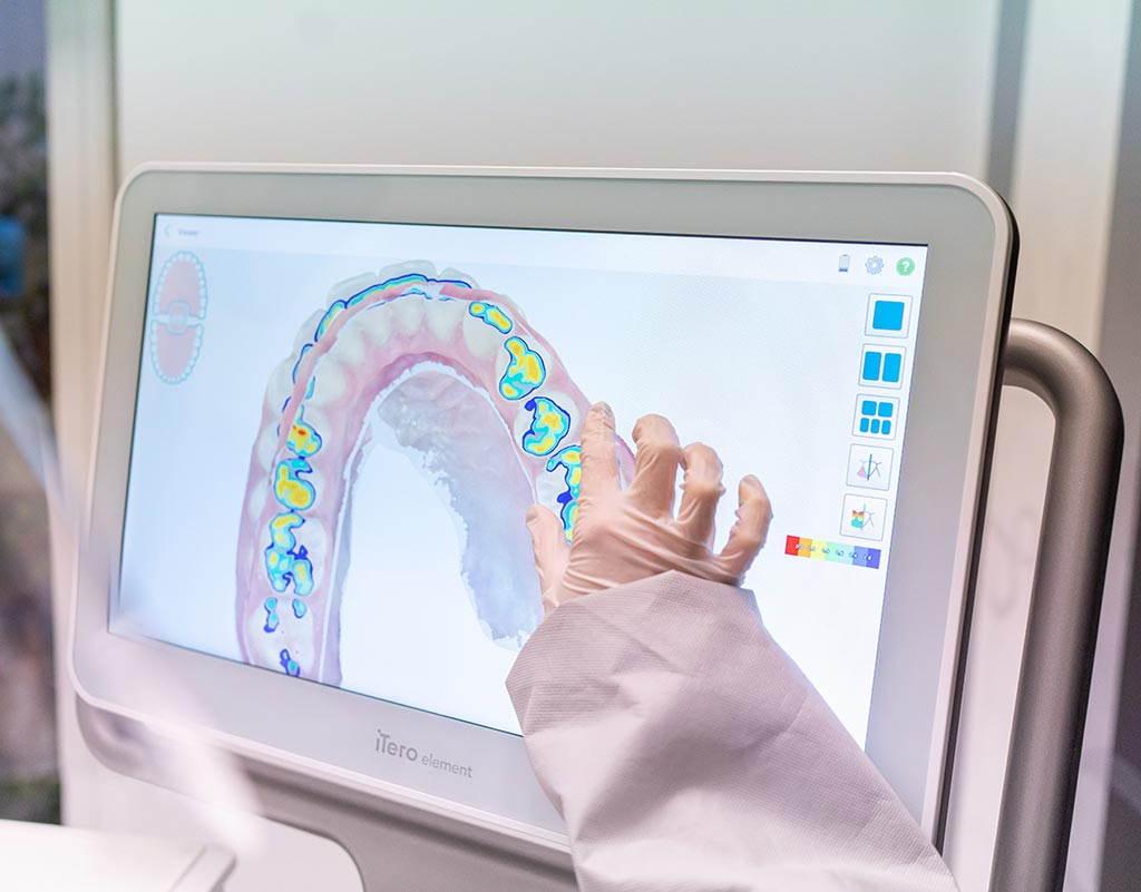 Tratamiento del desgaste dental