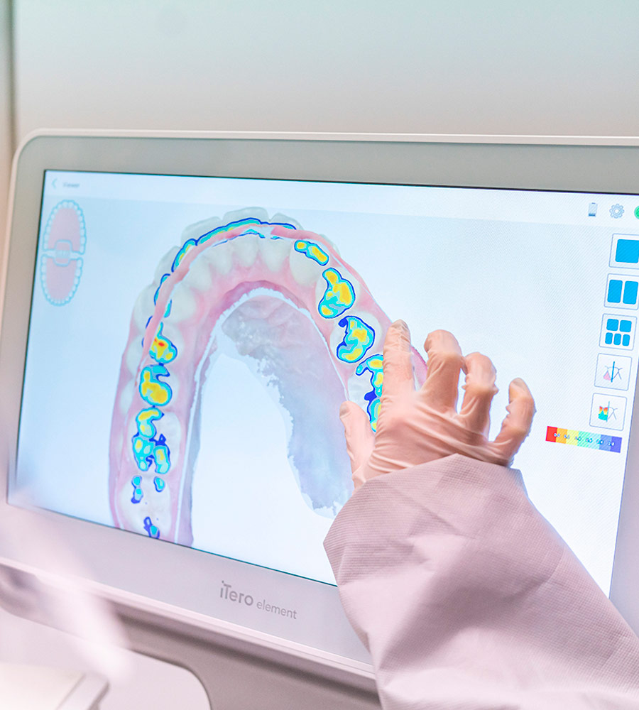 Detectar desgaste dental clínica Vilaboa