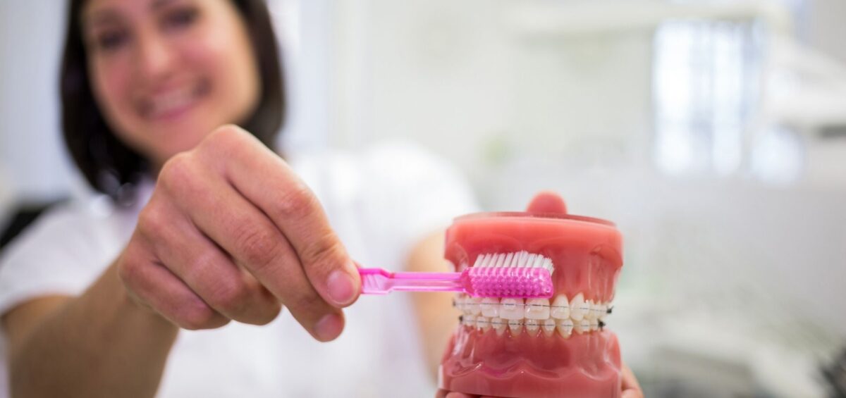 dentista cepillando modelo de dientes con brackets